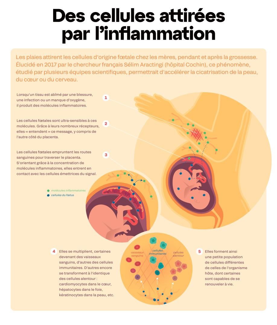 Image légendée