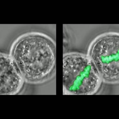 Voir la vidéo de Microscope optique / Cellule en division