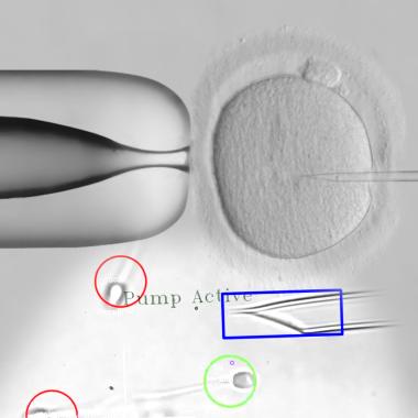 Voir la vidéo de Infertilité, la science progresse