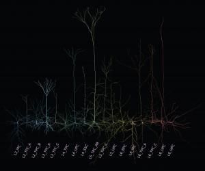 Une classification morphologique des neurones (enfin) 