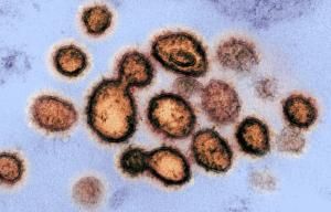 France : lancement d’un essai clinique sur le coronavirus