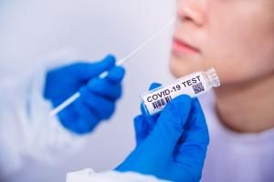 Les tests Covid-19 pris en charge à 100% par l&#039;Assurance Maladie pour les cas contacts ou les vaccinés, c&#039;est terminé